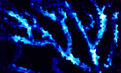 Figure 7(B) – The yellow bamboo coral, Ceratoisis flexibili, emits light when bumped. Photo credit: Edith A. Widder Harbor Branch Oceanographic Institution.