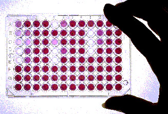  One format for screening of chemicals for bioactivity is to use a colorimetric assay, or test, that correlates with inhibition of an enzyme involved in a disease process. In this example, the purple wells are ones in which an enzyme involved in cancer cell proliferation is not inhibited; the clear wells are ones in which the enzyme was inhibited. This is an automated procedure: a "microwell plate reader" automatically correlates the relative color intensity with the degree of inhibition of the enzyme. (Harbor Branch Oceanographic Institution)